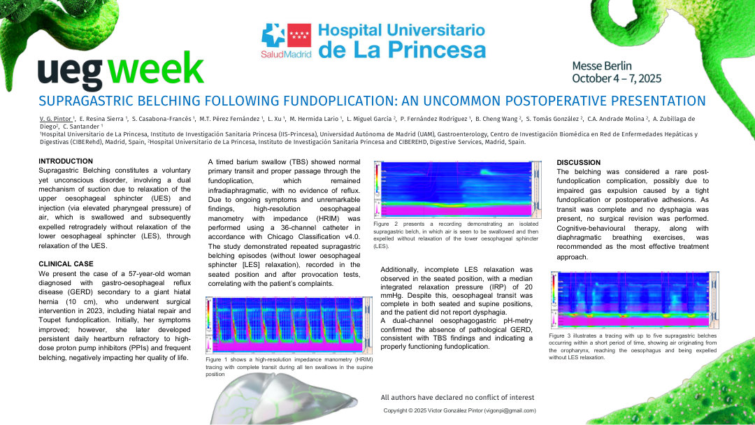 SUPRAGASTRIC BELCHING FOLLOWING FUNDOPLICATION: AN UNCOMMON POSTOPERATIVE PRESENTATION