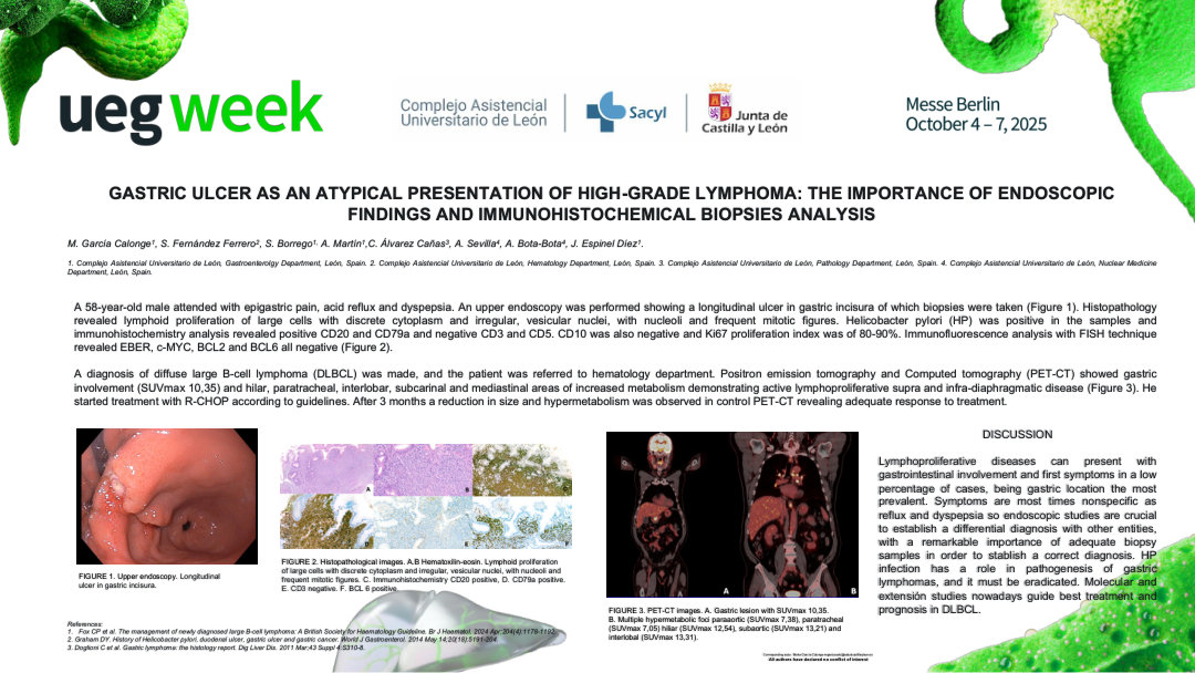 GASTRIC ULCER AS AN ATYPICAL PRESENTATION OF HIGH-GRADE LYMPHOMA: THE IMPORTANCE OF ENDOSCOPIC FINDINGS AND IMMUNOHISTOCHEMICAL BIOPSIES ANALYSIS