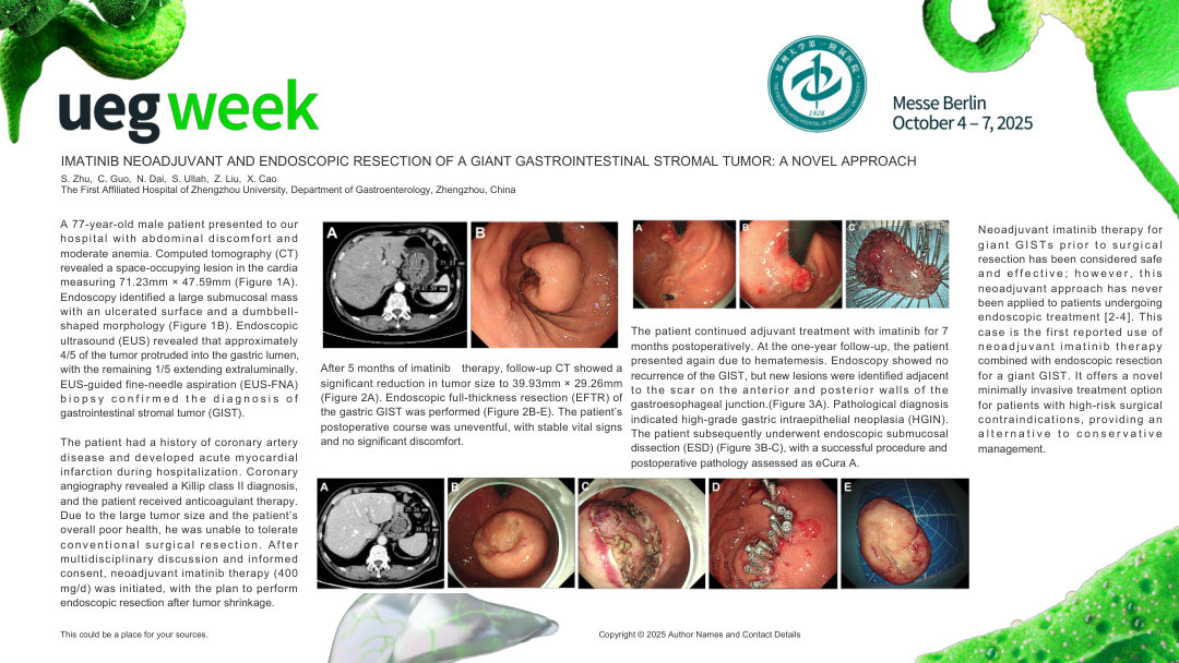 IMATINIB NEOADJUVANT AND ENDOSCOPIC RESECTION OF A GIANT GASTROINTESTINAL STROMAL TUMOR: A NOVEL APPROACH