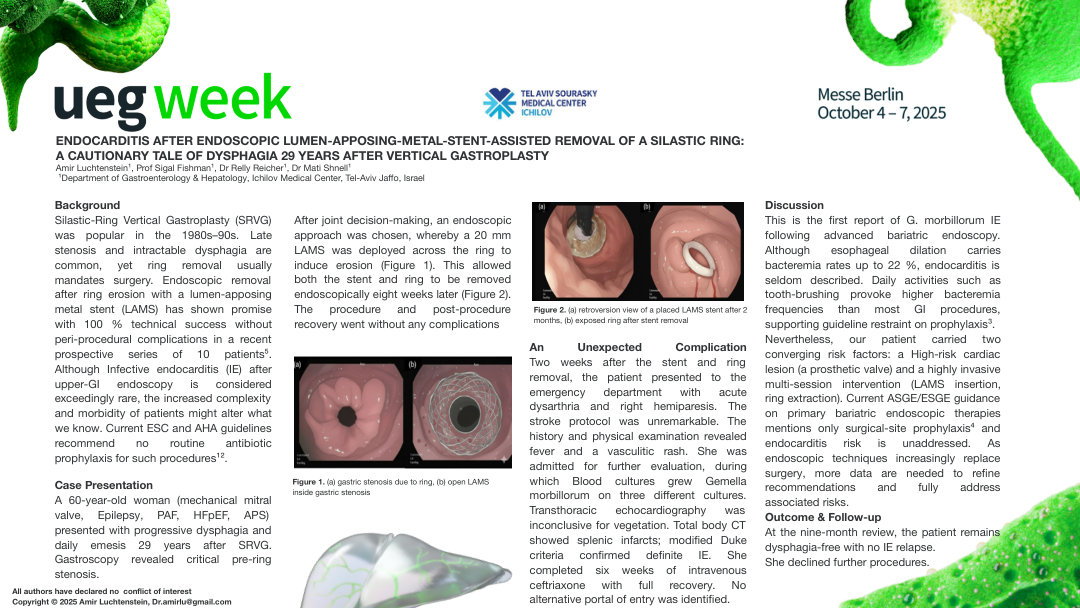 ENDOCARDITIS AFTER ENDOSCOPIC LUMEN-APPOSING-METAL-STENT-ASSISTED REMOVAL OF A SILASTIC RING: A CAUTIONARY TALE OF DYSPHAGIA 29 YEARS AFTER VERTICAL GASTROPLASTY