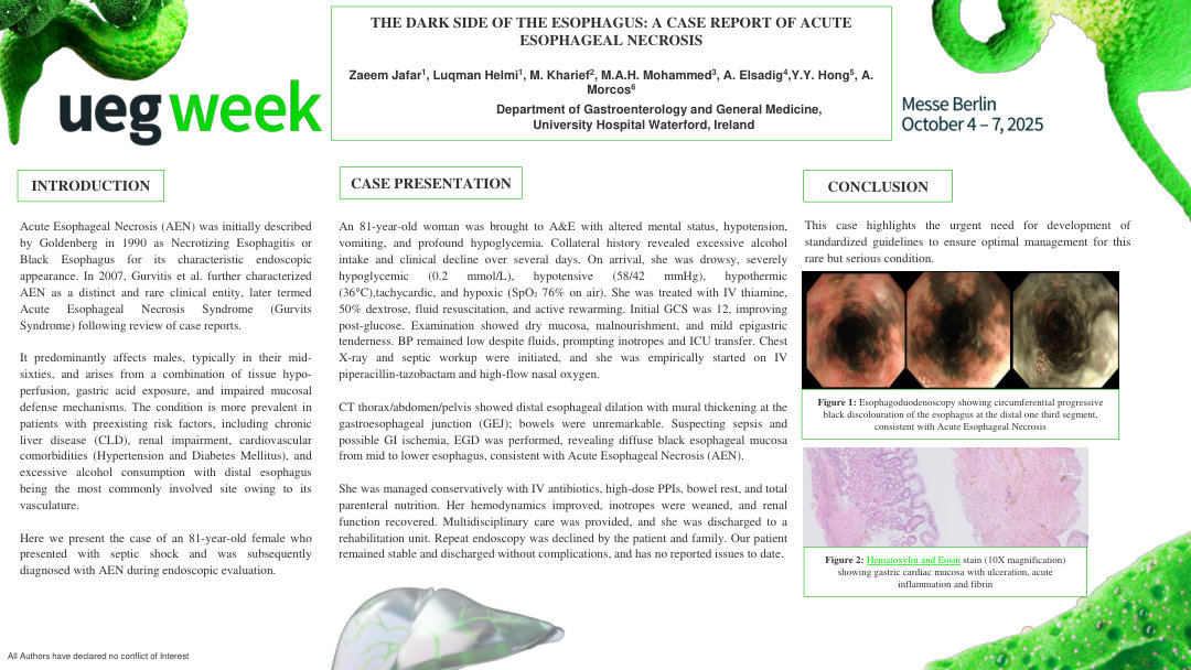 THE DARK SIDE OF THE ESOPHAGUS: A CASE REPORT OF ACUTE ESOPHAGEAL NECROSIS
