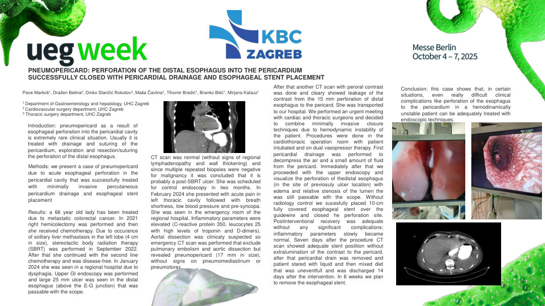 PNEUMOPERICARD: PERFORATION OF THE DISTAL ESOPHAGUS INTO THE PERICARD SUCESFULLY CLOSED WITH PERICARDIAL DRAINAGE AND ESOPHAGEAL STENT PLACEMENT