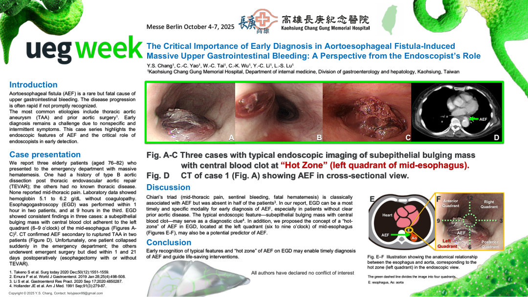 THE CRITICAL IMPORTANCE OF EARLY DIAGNOSIS IN AORTOESOPHAGEAL FISTULA-INDUCED MASSIVE UPPER GASTROINTESTINAL BLEEDING: A PERSPECTIVE FROM THE ENDOSCOPIST’S ROLE
