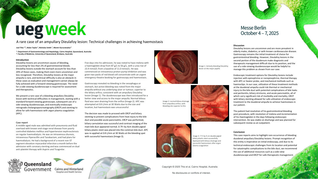A RARE CASE OF AN AMPULLARY DIEULAFOY LESION: TECHNICAL CHALLENGES IN ACHIEVING HAEMOSTASIS