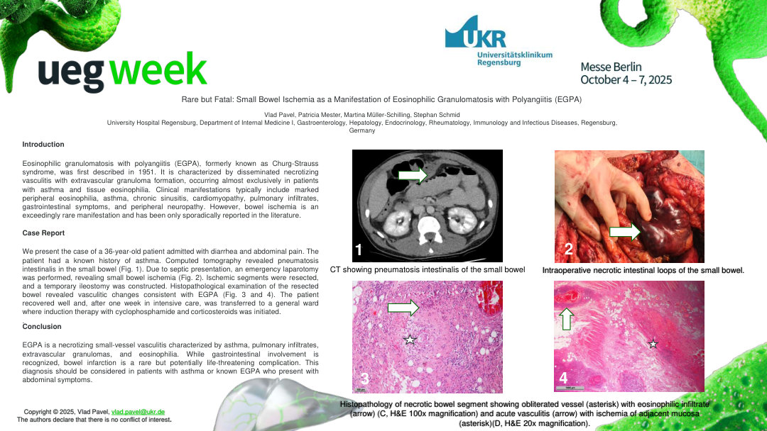 RARE BUT FATAL: SMALL BOWEL ISCHEMIA AS A MANIFESTATION OF EOSINOPHILIC GRANULOMATOSIS WITH POLYANGIITIS (EGPA)