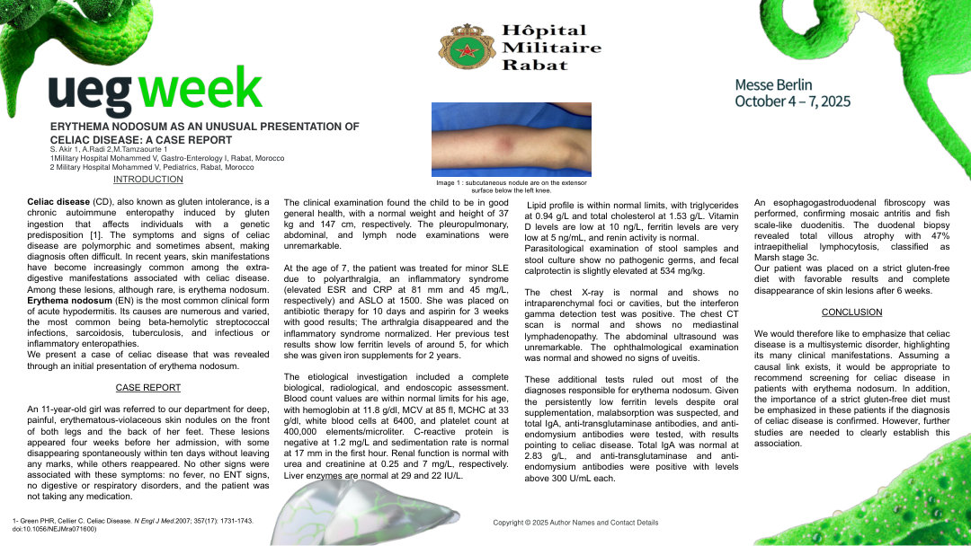 ERYTHEMA NODOSUM AS AN UNUSUAL PRESENTATION OF CELIAC DISEASE: A CASE REPORT