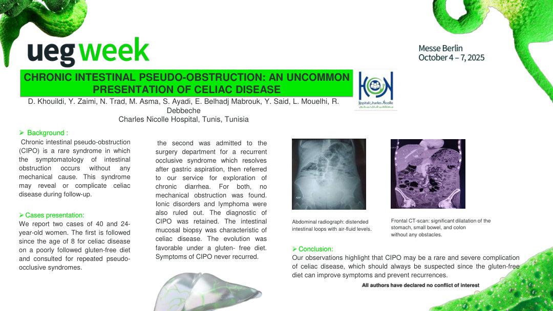 CHRONIC INTESTINAL PSEUDO-OBSTRUCTION: AN UNCOMMON PRESENTATION OF CELIAC DISEASE