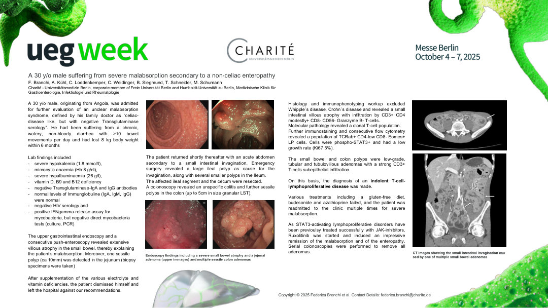 A 30 Y/O MALE SUFFERING FROM SEVERE MALABSORPTION SECONDARY TO A NON-CELIAC ENTEROPATHY: INDOLENT T-CELL- LYMPHOPROLIFERATIVE DISEASE