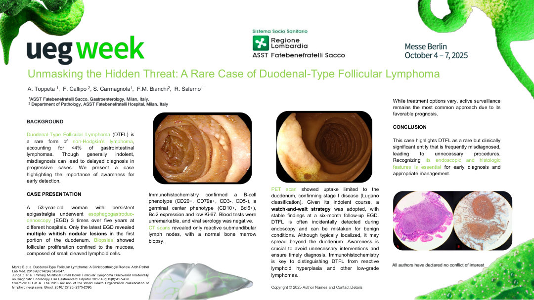 UNMASKING THE HIDDEN THREAT: A RARE CASE OF DUODENAL-TYPE FOLLICULAR LYMPHOMA