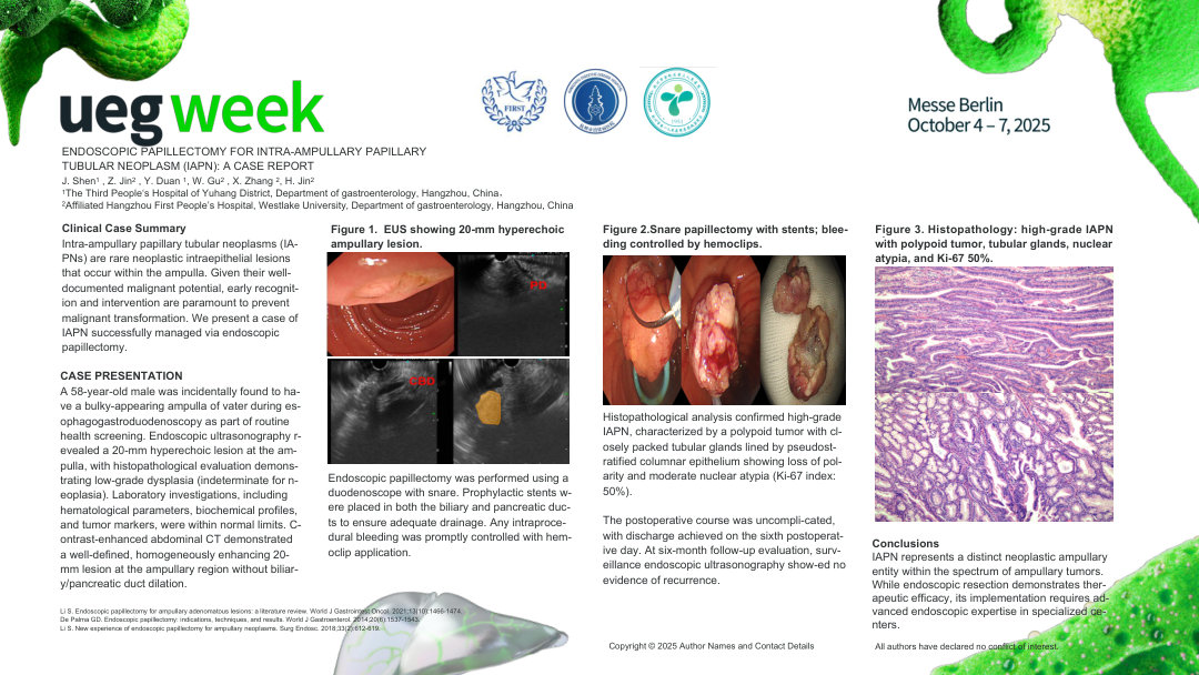 ENDOSCOPIC PAPILLECTOMY FOR INTRA-AMPULLARY PAPILLARY TUBULAR NEOPLASM (IAPN): A CASE REPORT