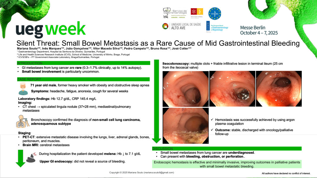 SILENT THREAT: SMALL BOWEL METASTASIS AS A RARE CAUSE OF MID-GASTROINTESTINAL BLEEDING