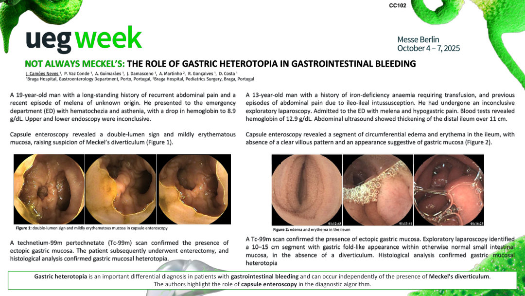 NOT ALWAYS MECKEL’S: THE ROLE OF GASTRIC HETEROTOPIA IN GASTROINTESTINAL BLEEDING