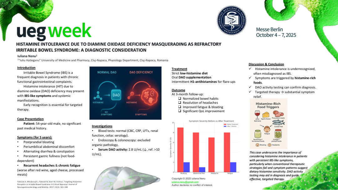 HISTAMINE INTOLERANCE DUE TO DIAMINE OXIDASE DEFICIENCY MASQUERADING AS REFRACTORY IRRITABLE BOWEL SYNDROME: A DIAGNOSTIC CONSIDERATION