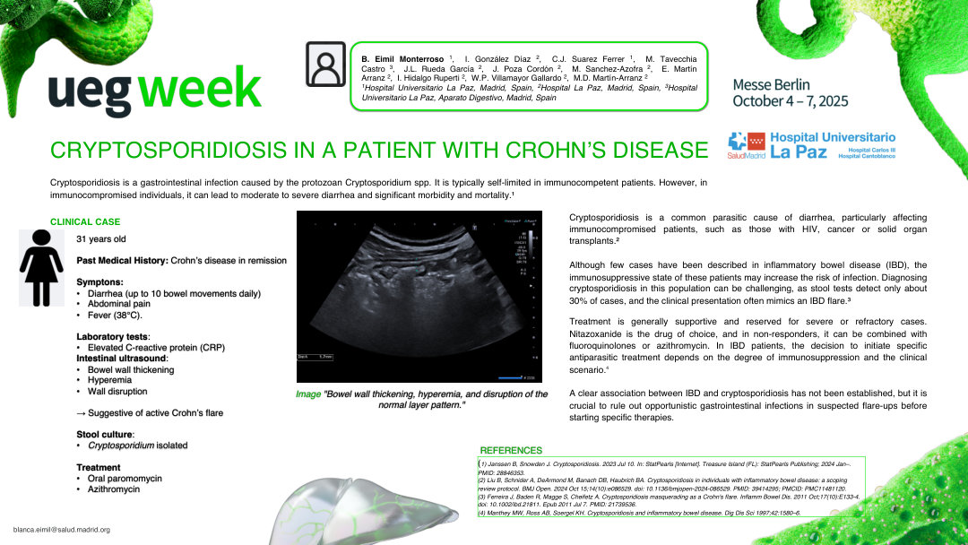 CRYPTOSPORIDIOSIS IN A PATIENT WITH CROHN’S DISEASE
