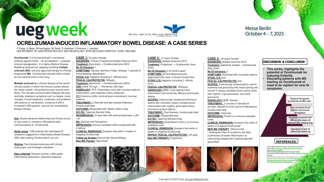OCRELIZUMAB-INDUCED INFLAMMATORY BOWEL DISEASE: A CASE SERIES IN MULTIPLE SCLEROSIS PATIENTS