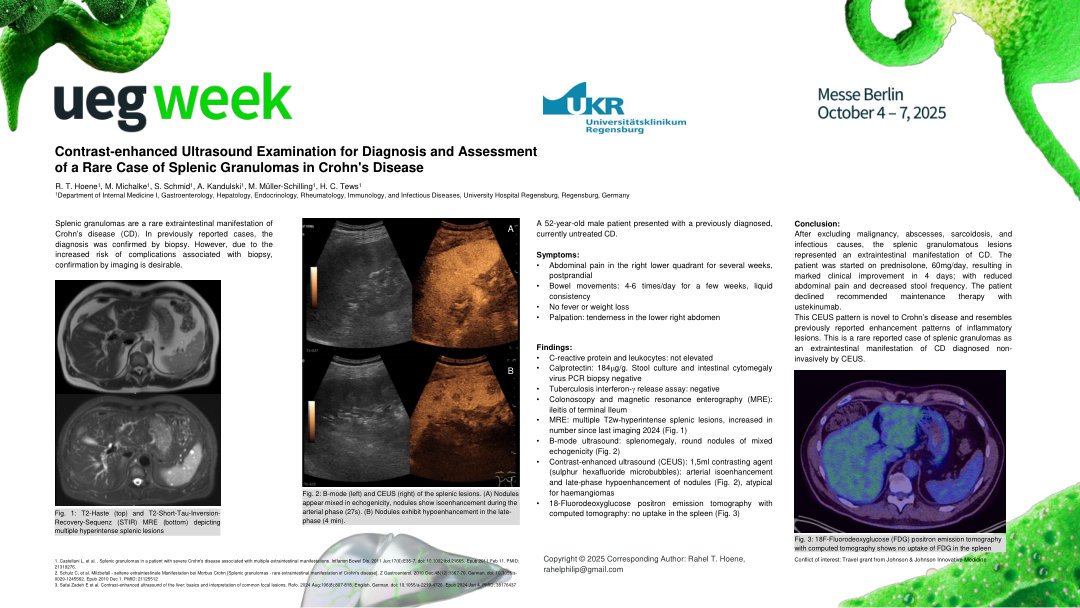 CONTRAST-ENHANCED ULTRASOUND EXAMINATION FOR DIAGNOSIS AND ASSESSMENT OF A RARE CASE OF SPLENIC GRANULOMAS IN CROHN'S DISEASE