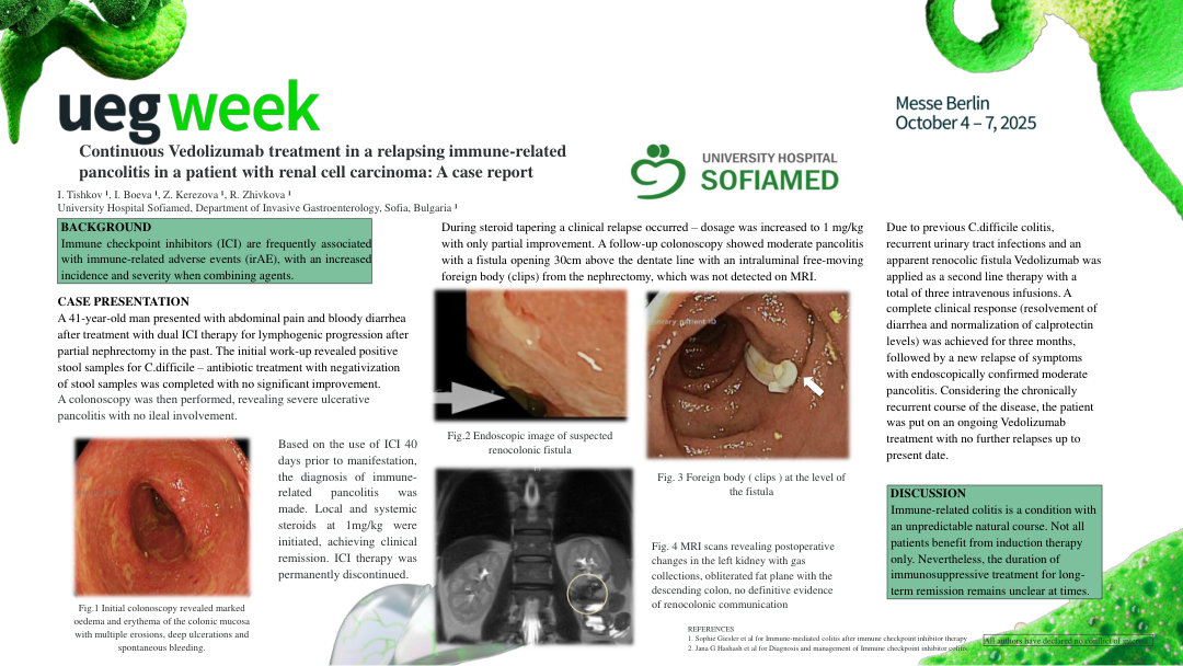 CONTINUOUS VEDOLIZUMAB TREATMENT IN A RELAPSING IMMUNE-RELATED PANCOLITIS IN A PATIENT WITH RENAL CELL CARCINOMA: A CASE REPORT