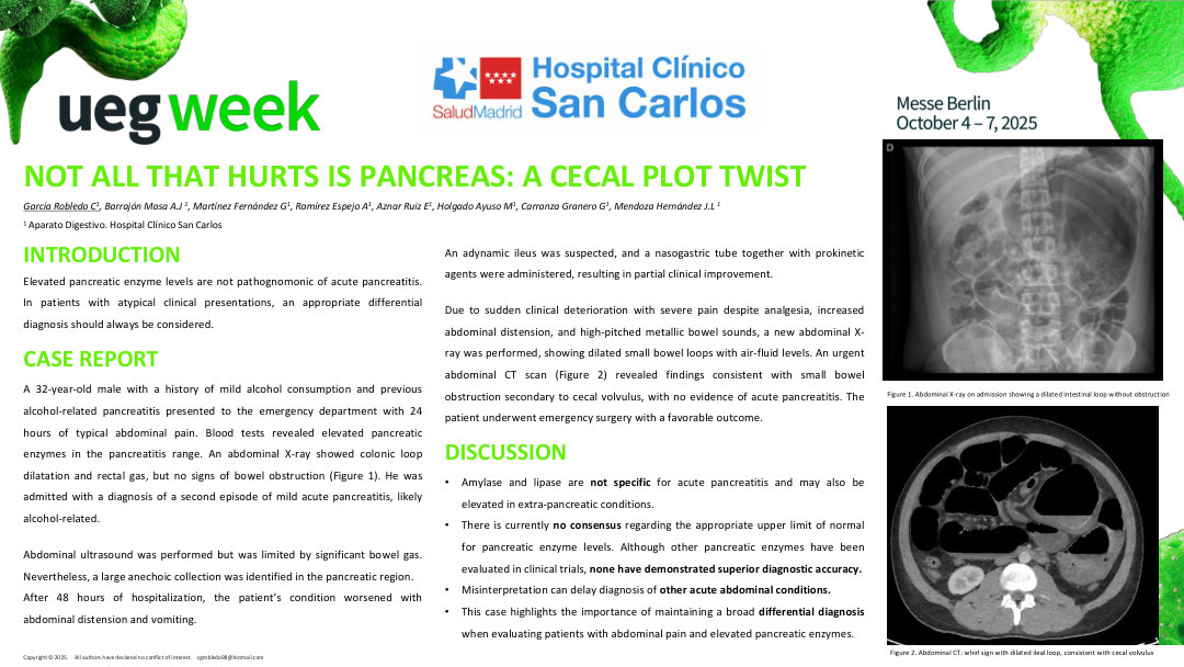 NOT ALL THAT HURTS IS PANCREAS: A CECAL PLOT TWIST