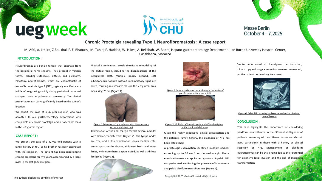 CHRONIC PROCTALGIA REVEALING TYPE 1 NEUROFIBROMATOSIS: A CASE REPORT