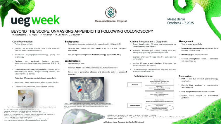 BEYOND THE SCOPE: UNMASKING APPENDICITIS FOLLOWING COLONOSCOPY
