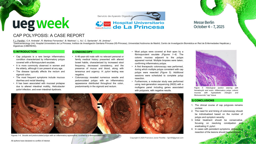 CAP POLYPOSIS: A CASE REPORT