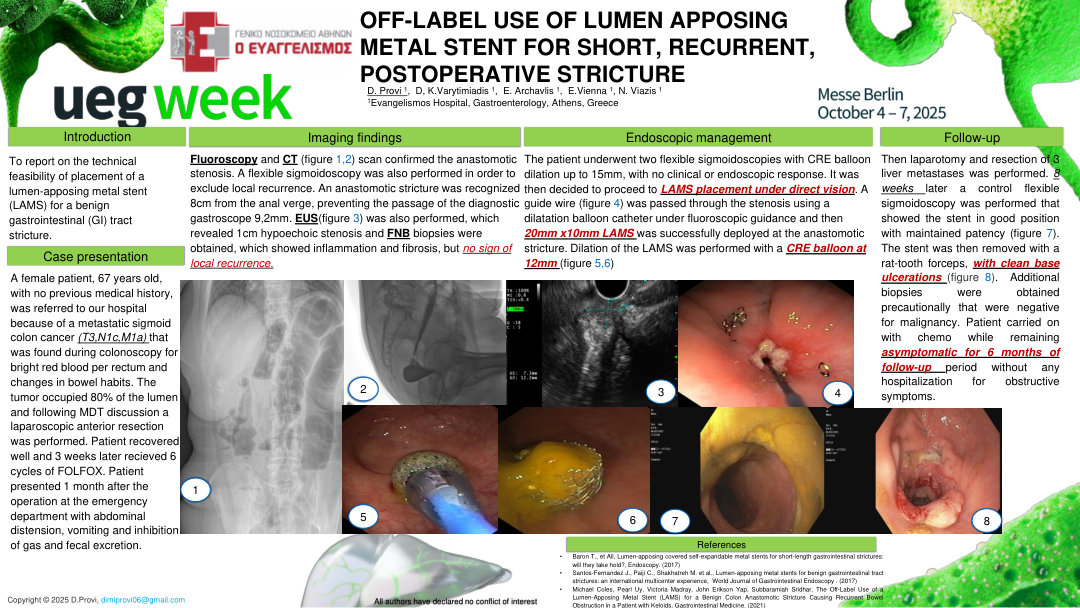OFF-LABEL USE OF LUMEN APPOSING METAL STENT FOR SHORT, RECURRENT, POSTOPERATIVE STRICTURE