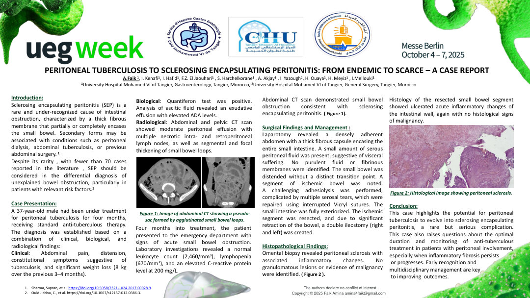 PERITONEAL TUBERCULOSIS TO SCLEROSING ENCAPSULATING PERITONITIS: FROM ENDEMIC TO SCARCE – A CASE REPORT