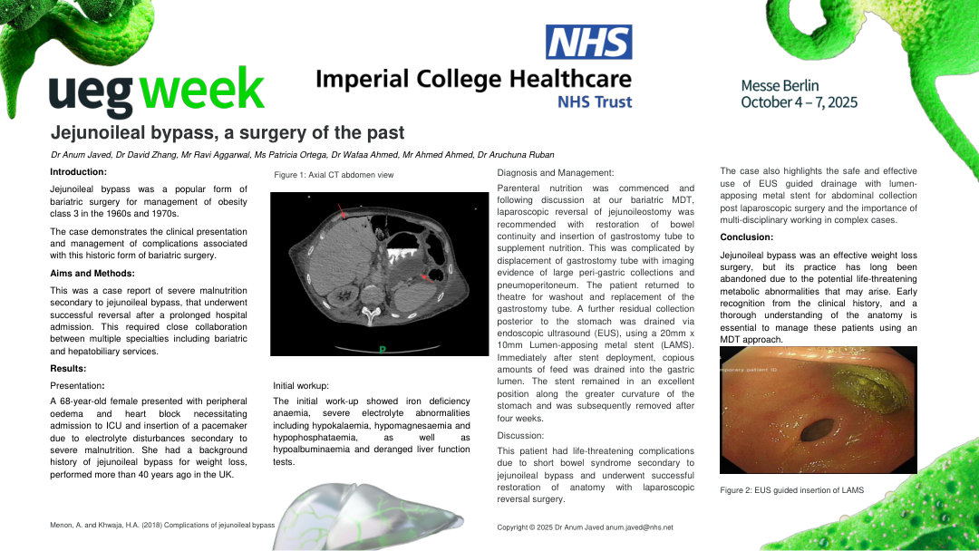 JEJUNOILEAL BYPASS, A SURGERY OF THE PAST