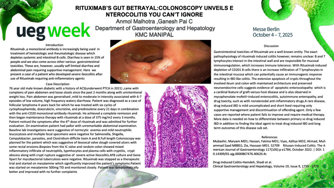 RITUXIMAB’S GUT BETRAYAL:COLONOSCOPY UNVEILS ENTEROCOLITIS YOU CAN’T IGNORE