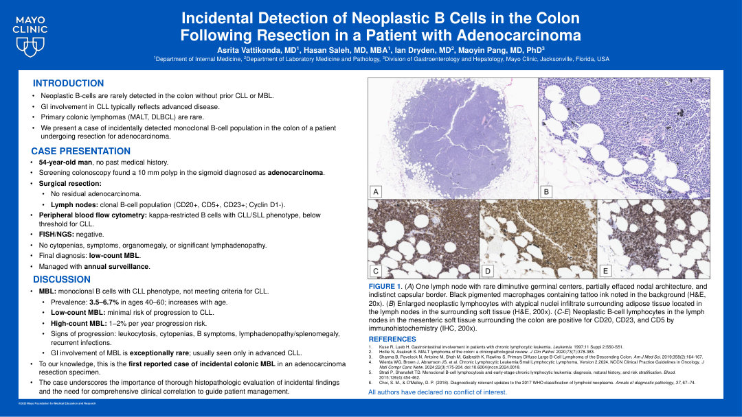 INCIDENTAL DETECTION OF NEOPLASTIC B CELLS IN THE COLON FOLLOWING RESECTION IN A PATIENT WITH ADENOCARCINOMA