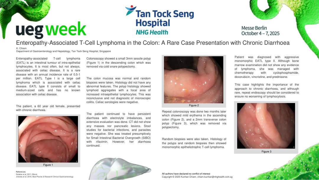 ENTEROPATHY-ASSOCIATED T-CELL LYMPHOMA IN THE COLON: A RARE CASE PRESENTATION WITH CHRONIC DIARRHOEA