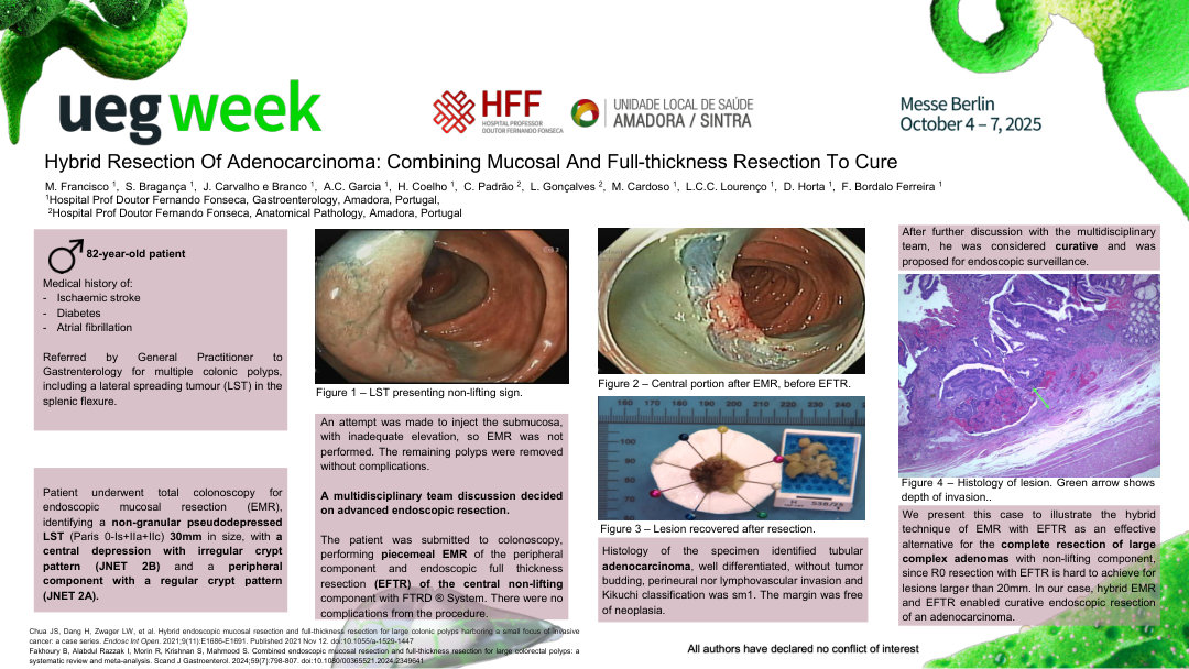 HYBRID RESECTION OF ADENOCARCINOMA: COMBINING MUCOSAL AND FULL-THICKNESS RESECTION TO CURE