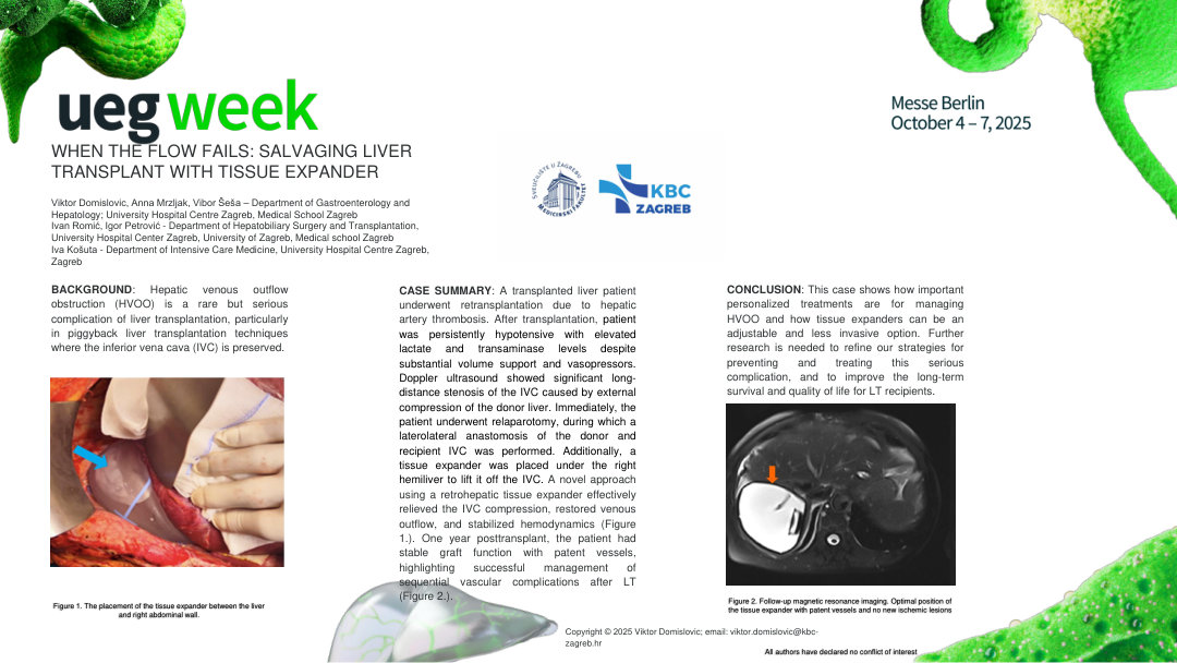 WHEN THE FLOW FAILS: SALVAGING LIVER TRANSPLANT WITH TISSUE EXPANDER