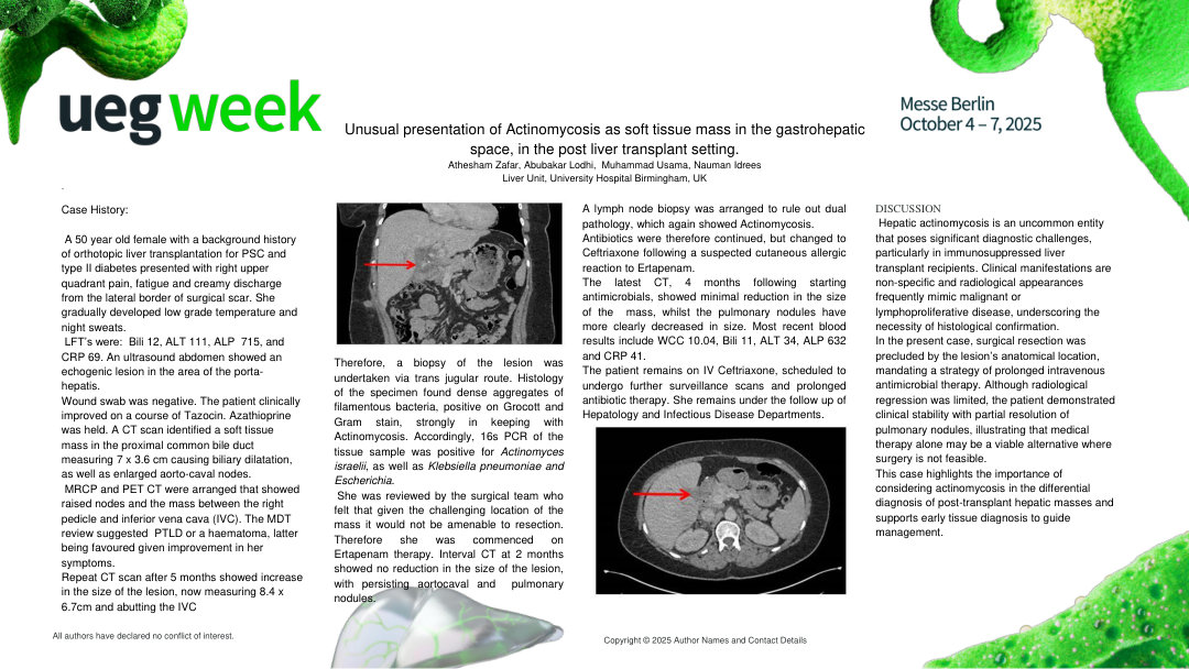 UNUSUAL PRESENTATION OF ACTINOMYCOSIS AS SOFT TISSUE MASS IN THE GASTROHEPATIC SPACE, IN THE POST LIVER TRANSPLANT SETTING