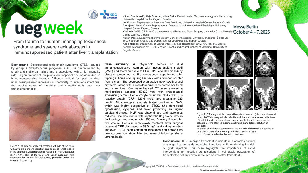 FROM TRAUMA TO TRIUMPH: MANAGING TOXIC SHOCK SYNDROME AND SEVERE NECK ABSCESS IN IMMUNOSUPPRESSED PATIENT AFTER LIVER TRANSPLANTATION