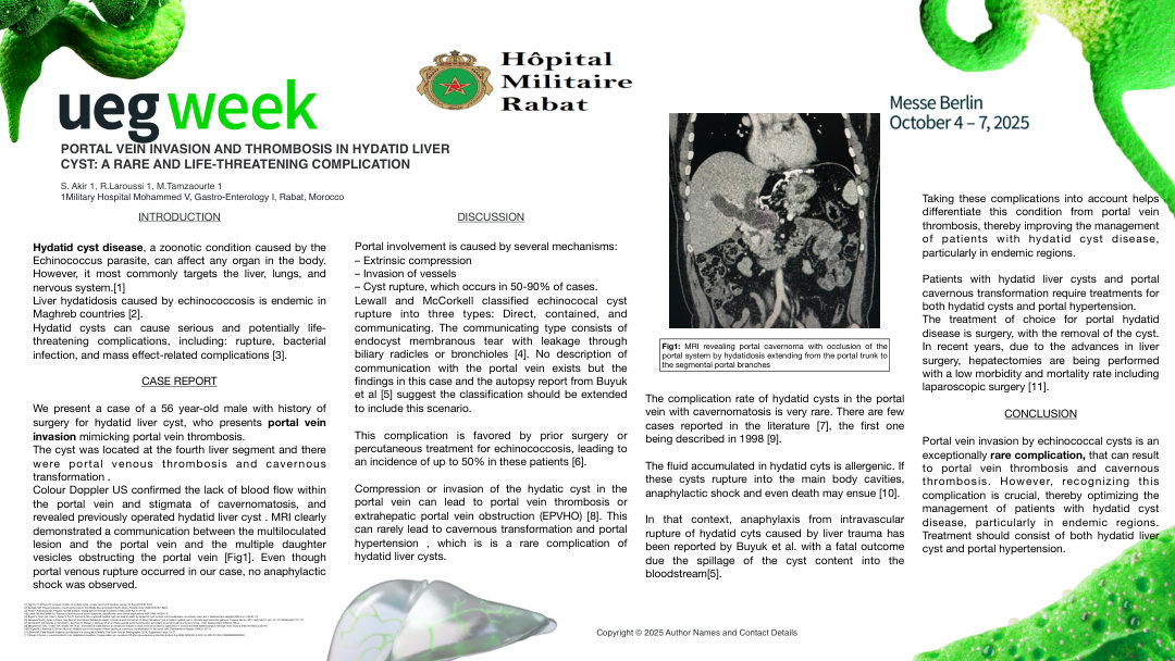 PORTAL VEIN INVASION AND THROMBOSIS IN HYDATID LIVER CYST: A RARE AND LIFE-THREATENING COMPLICATION