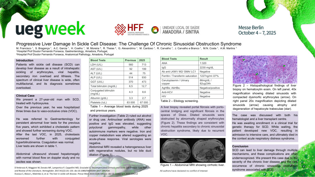 PROGRESSIVE LIVER DAMAGE IN SICKLE CELL DISEASE: THE CHALLENGE OF CHRONIC SINUSOIDAL OBSTRUCTION SYNDROME