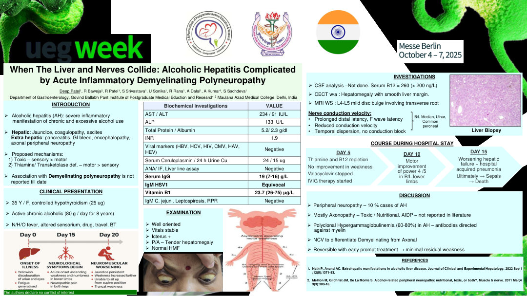 WHEN THE LIVER AND NERVES COLLIDE: ALCOHOLIC HEPATITIS COMPLICATED BY ACUTE INFLAMMATORY DEMYELINATING POLYNEUROPATHY
