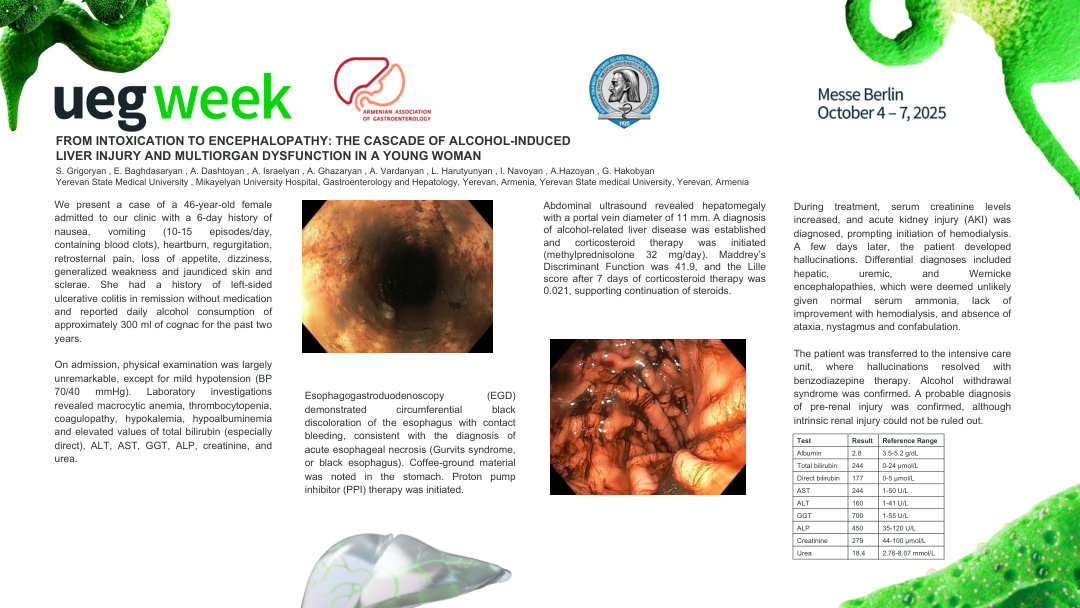 FROM INTOXICATION TO ENCEPHALOPATHY: THE CASCADE OF ALCOHOL-INDUCED LIVER INJURY AND MULTIORGAN DYSFUNCTION IN A YOUNG WOMAN