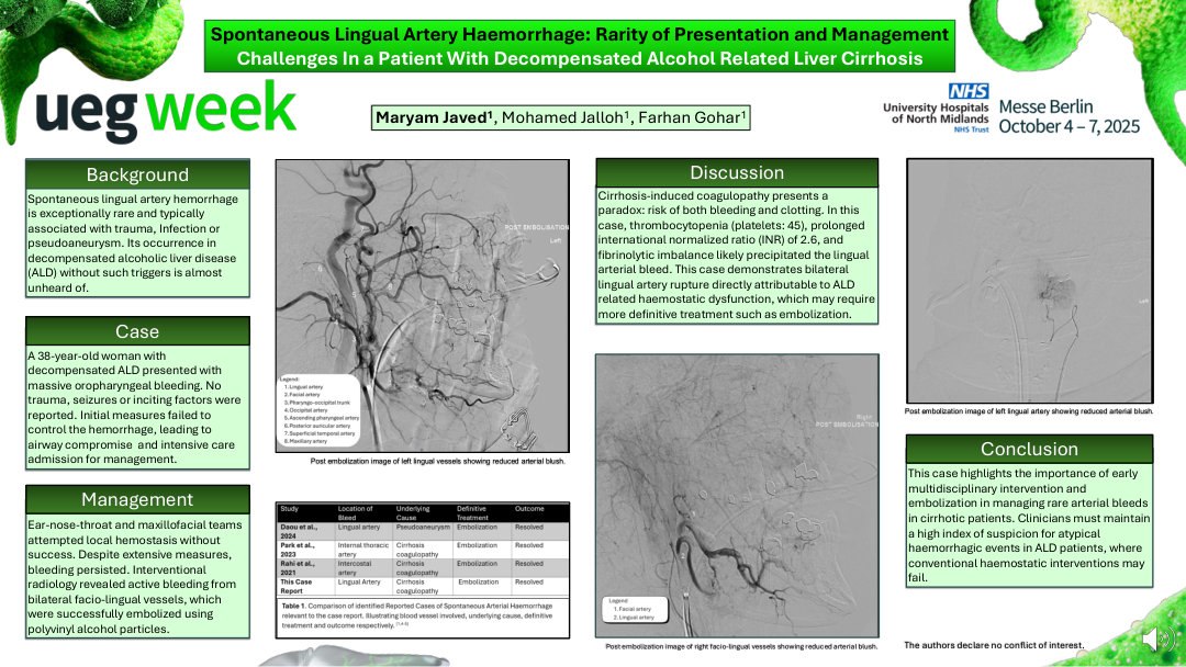 SPONTANEOUS LINGUAL ARTERY HAEMORRHAGE: RARITY OF PRESENTATION AND MANAGEMENT CHALLENGES IN A PATIENT WITH DECOMPENSATED ALCOHOL RELATED LIVER CIRRHOSIS