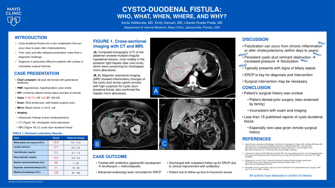 CYSTO-DUODENAL FISTULA: WHO, WHAT, WHEN, WHERE, AND WHY?