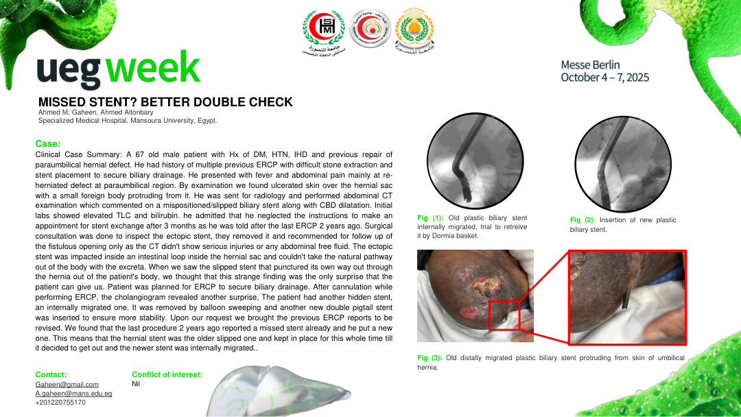 MISSED STENT? BETTER DOUBLE CHECK