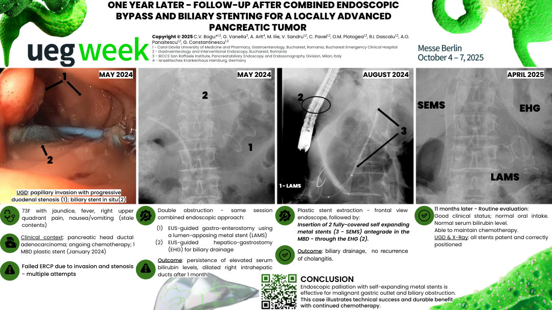 ONE YEAR LATER - FOLLOW-UP AFTER COMBINED ENDOSCOPIC BYPASS AND BILIARY STENTING FOR A LOCALLY ADVANCED PANCREATIC TUMOR