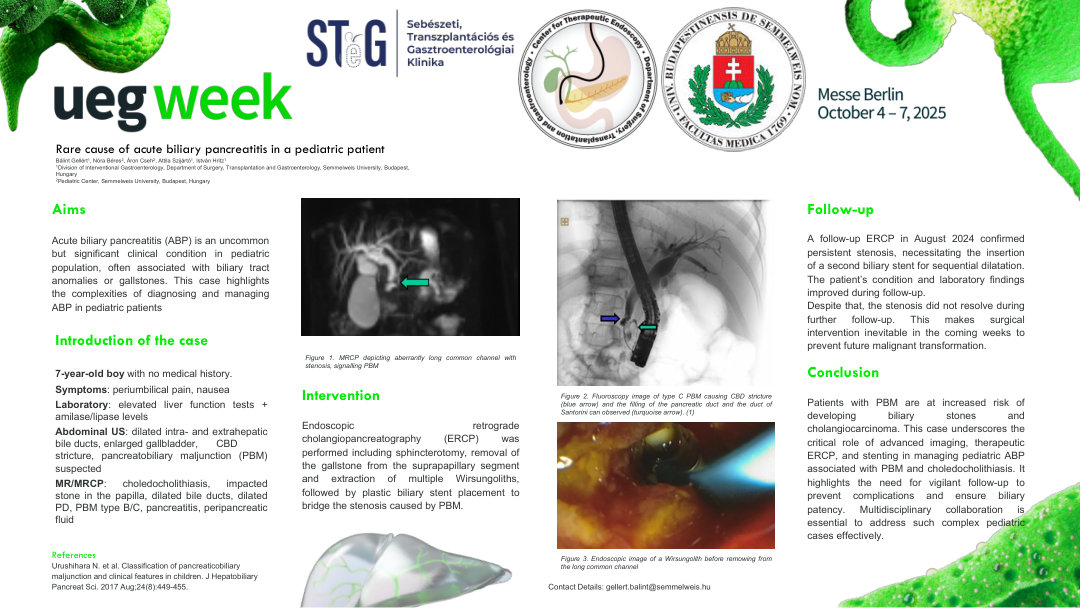 RARE CAUSE OF ACUTE BILIARY PANCREATITIS IN A PEDIATRIC PATIENT