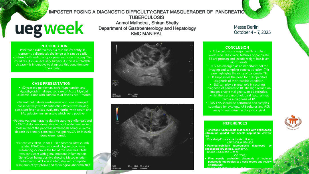 IMPOSTER POSING A DIAGNOSTIC DIFFICULTY – GREAT MASQUERADER OF PANCREATIC TUBERCULOSIS