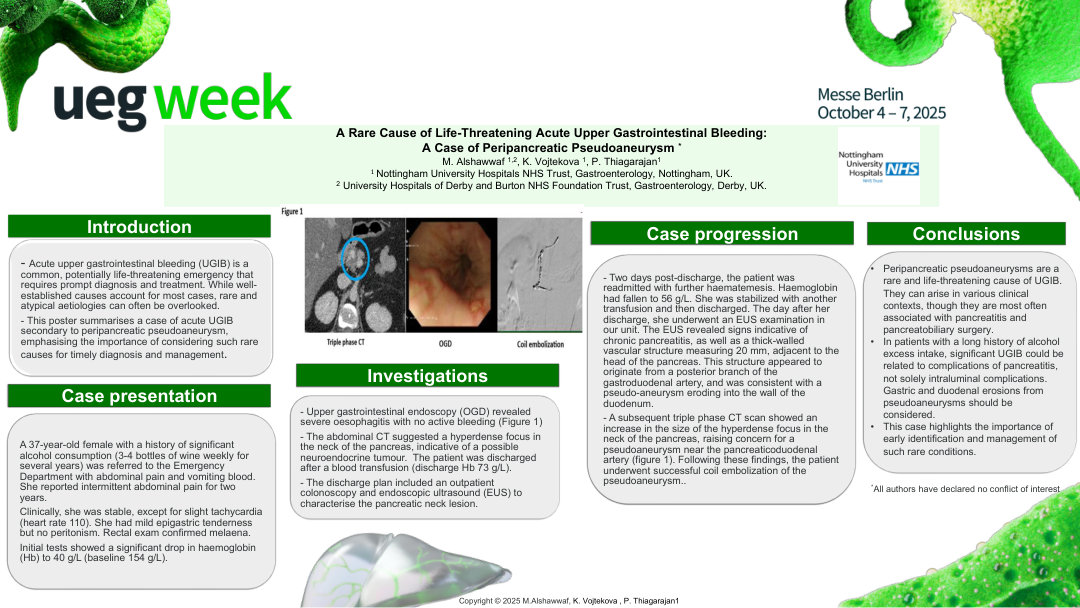 AN UNCOMMON CAUSE OF LIFE-THREATENING ACUTE UPPER GASTROINTESTINAL BLEEDING: PERIPANCREATIC PSEUDOANEURYSM – A CASE REPORT