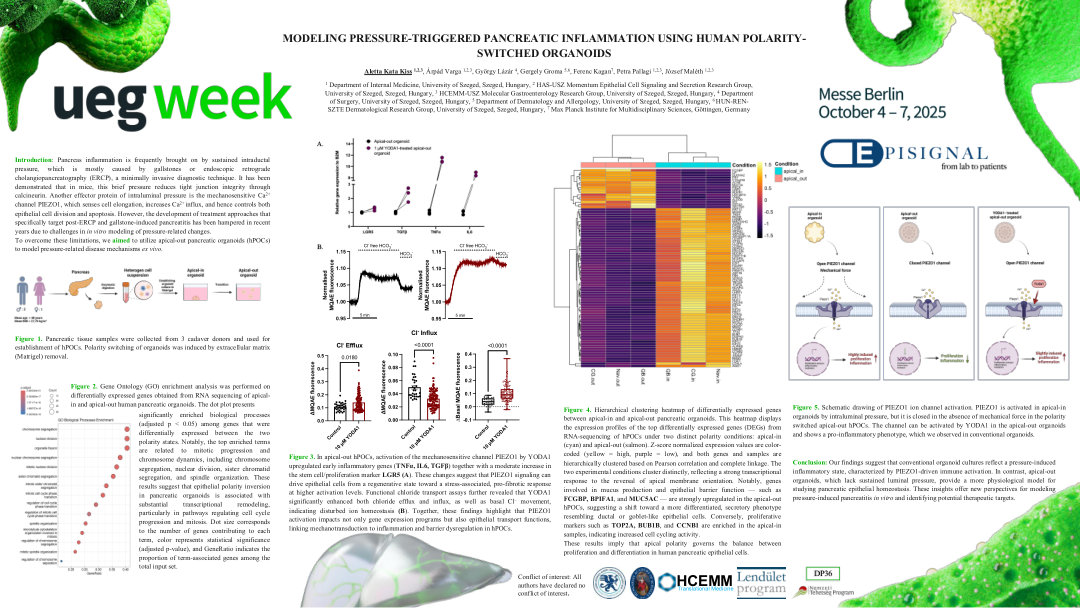 MODELING PRESSURE-TRIGGERED PANCREATIC INFLAMMATION USING HUMAN POLARITY-SWITCHED ORGANOIDS
