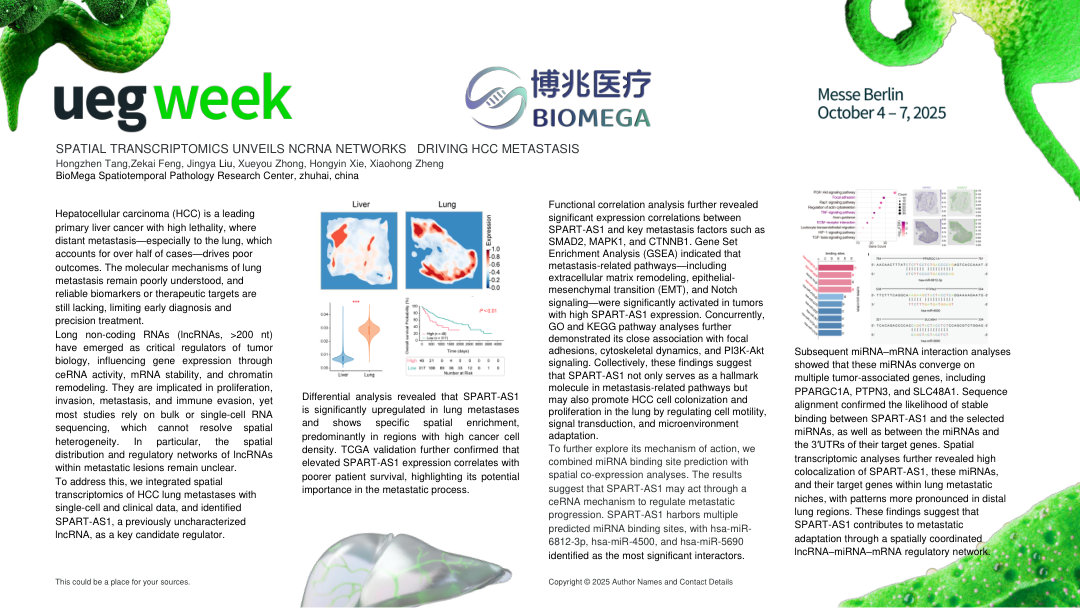 SPATIAL TRANSCRIPTOMICS UNVEILS NCRNA NETWORKS DRIVING HCC METASTASIS