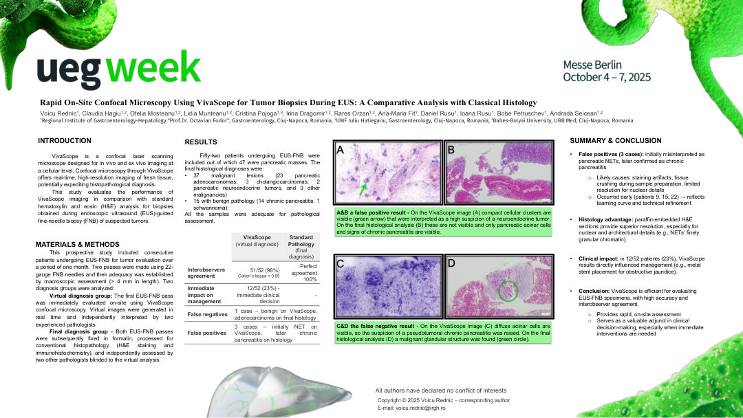 RAPID ON-SITE CONFOCAL MICROSCOPY USING VIVASCOPE FOR TUMOR BIOPSIES DURING EUS: A COMPARATIVE ANALYSIS WITH CLASSICAL HISTOLOGY