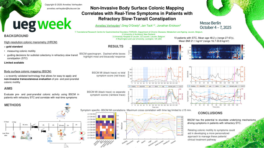 NON-INVASIVE BODY SURFACE COLONIC MAPPING CORRELATES WITH REAL-TIME SYMPTOMS IN PATIENTS WITH REFRACTORY SLOW-TRANSIT CONSTIPATION